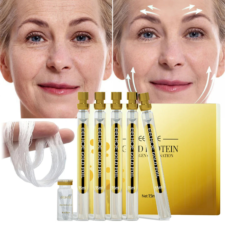 Collagen Thread Absorbable Face Filler Anti-aging Skin Care